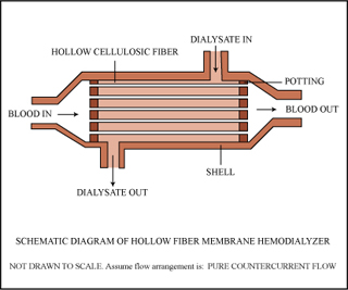 An illustration of a hollow fiber membrane hemodialyzer. The illustration calls out important features of the device as well as the indicating the flow of fluids.